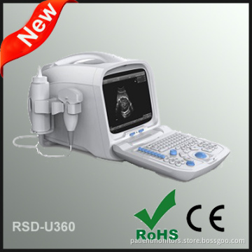 Portable Full Digital Ultrasonic Diagnostic System